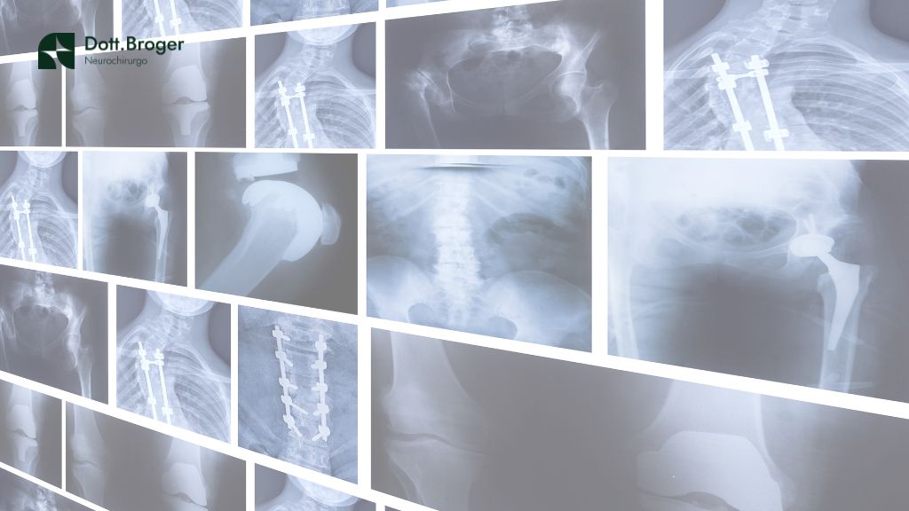 radiografie