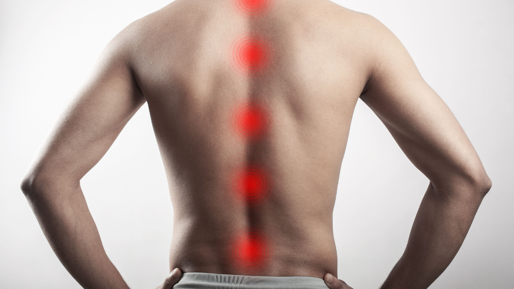 Fibromialgia o patologia vertebrale