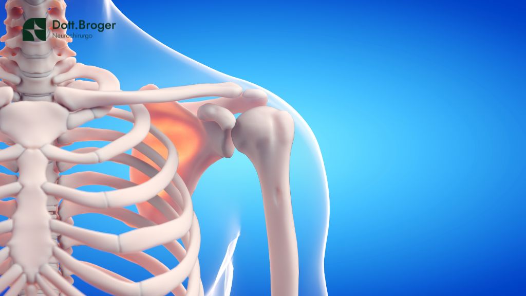 infezioni chirurgiche vertebre